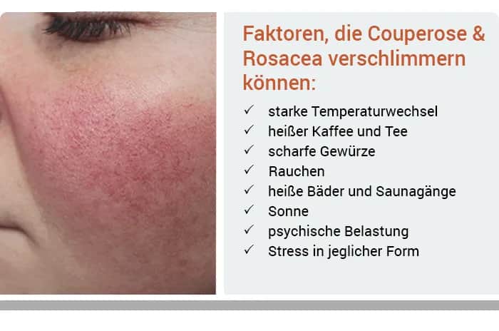 Rote Gesichtshaut: Ursachen, Symptome und wirksame Behandlungen