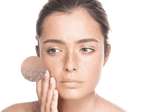 Sehr trockene Gesichtshaut: Ursachen, Symptome und effektive Pflege Tipps