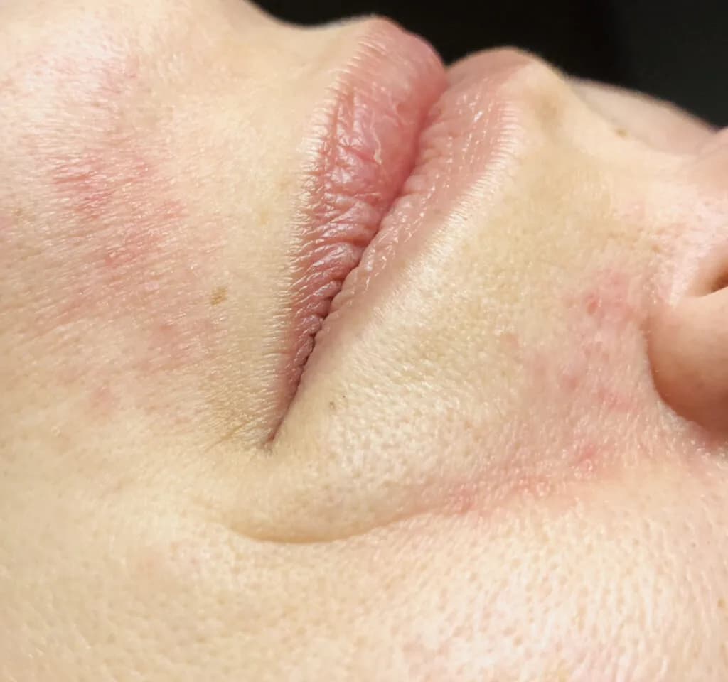 Raue Gesichtshaut: Ursachen und effektive Tipps zur Verbesserung