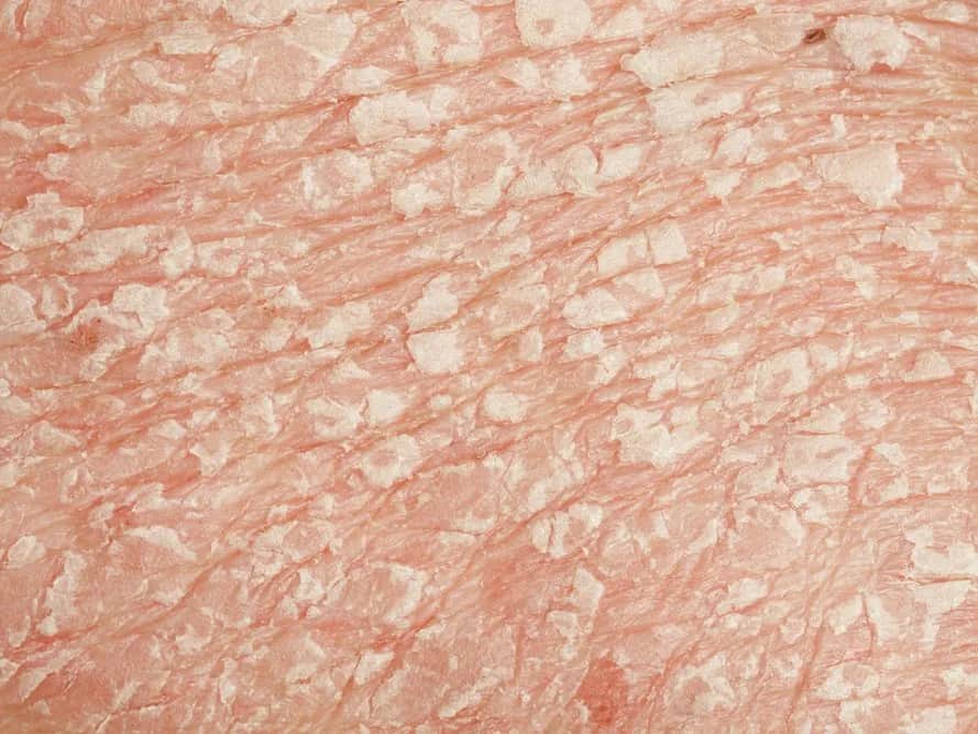 Trockene Gesichtshaut mit Schuppen: Ursachen und effektive Lösungen